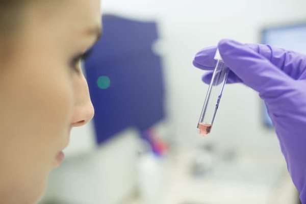 Veille concurrentielle : comment analyser les résultats ?